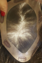 Doğal Saç Tepelik Protez Saç - Thumbnail